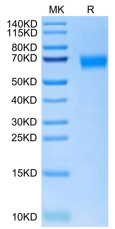 Cynomolgus NOGOR on Tris-Bis PAGE under reduced condition. The purity is greater than 95%.Recombinant Cynomolgus NOGOR Protein, Active