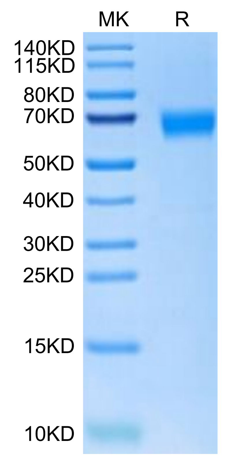 Cynomolgus NOGOR on Tris-Bis PAGE under reduced condition. The purity is greater than 95%.Recombinant Cynomolgus NOGOR Protein, Active