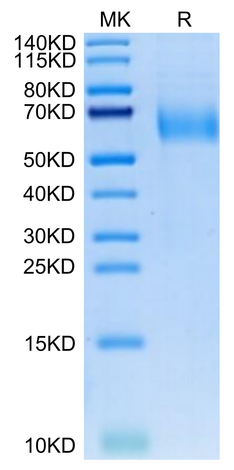 Canine IL-23R on Tris-Bis PAGE under reduced condition. The purity is greater than 95%.Recombinant Canine IL-23R Protein, Active