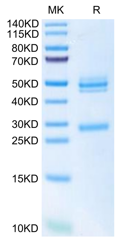 Mouse IL-12 on Tris-Bis PAGE under reduced condition. The purity is greater than 95%.Recombinant Mouse IL-12 Protein