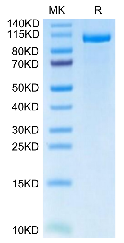 Human LRP-5 on Tris-Bis PAGE under reduced condition. The purity is greater than 95%.Recombinant Human LRP-5-Protein, Active