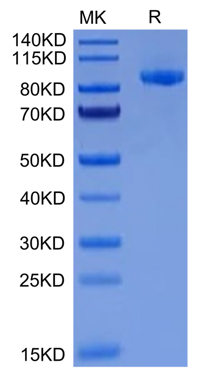 Cynomolgus EPHA2 on Tris-Bis PAGE under reduced condition. The purity is greater than 95%.Recombinant Cynomolgus EPHA2 Protein