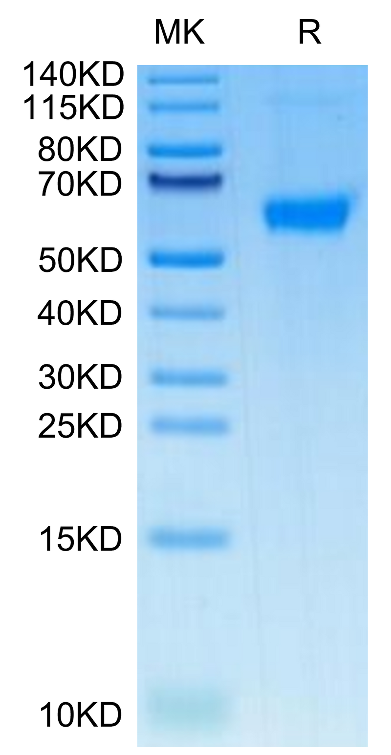 Human TNFRSF11B on Tris-Bis PAGE under reduced condition. The purity is greater than 95%.Recombinant Human TNFRSF11B Protein, Active