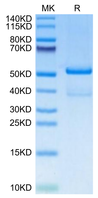 Human TACI on Tris-Bis PAGE under reduced condition. The purity is greater than 95%.Recombinant Human TACI/TNFRSF13B Protein, Active