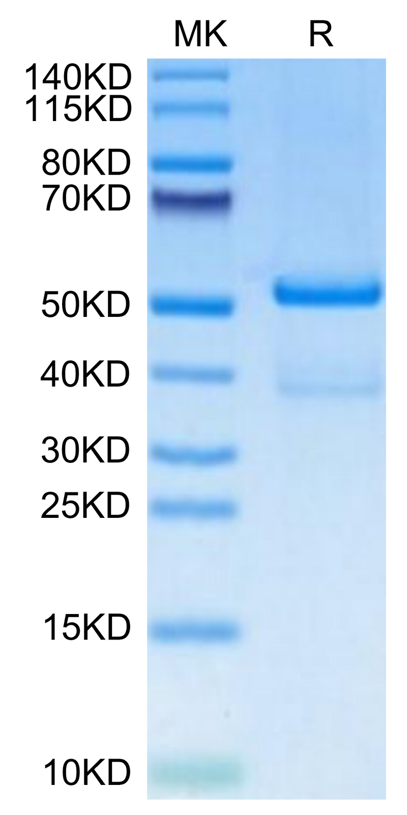 Human TACI on Tris-Bis PAGE under reduced condition. The purity is greater than 95%.Recombinant Human TACI/TNFRSF13B Protein, Active