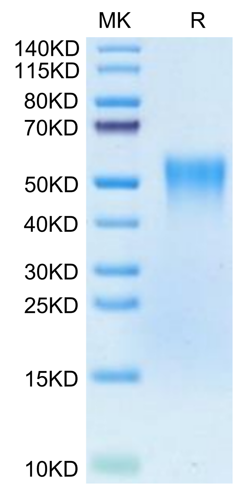 Biotinylated Human TNFR2 on Tris-Bis PAGE under reduced condition. The purity is greater than 95%.Biotinylated Human TNFR2/CD120b/TNFRSF1B Protein (Primary Amine Labeling), Active
