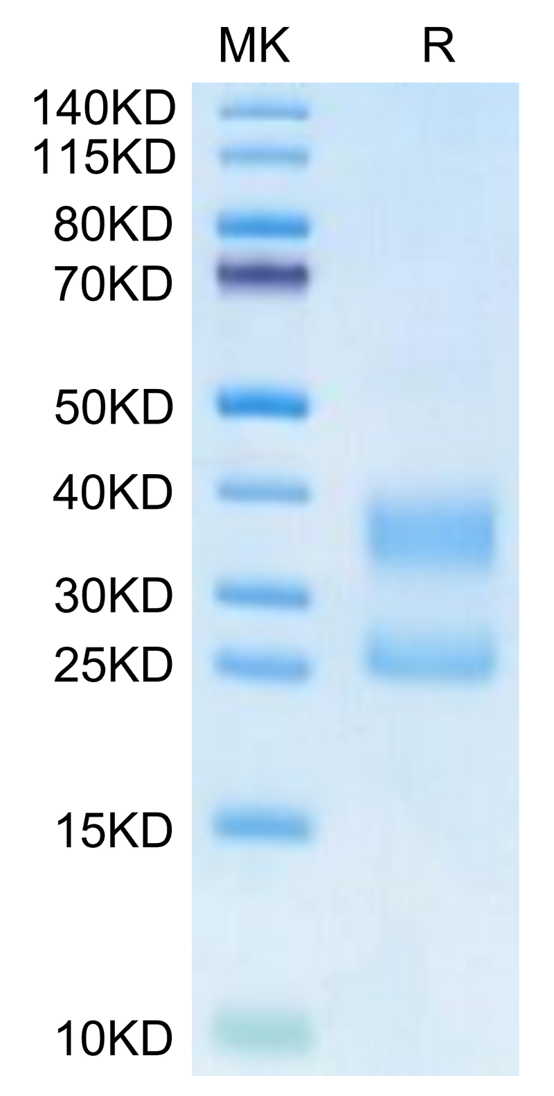 Biotinylated Human CD3E&CD3G on Tris-Bis PAGE under reduced condition. The purity is greater than 95%.Biotinylated Human CD3E&CD3G/CD3 epsilon&CD3 gamma Protein (Primary Amine Labeling), Active