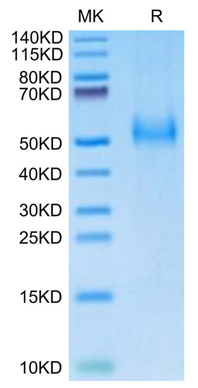 Human uPAR on Tris-Bis PAGE under reduced condition. The purity is greater than 95%.Recombinant Human uPAR/PLAUR Protein, Active