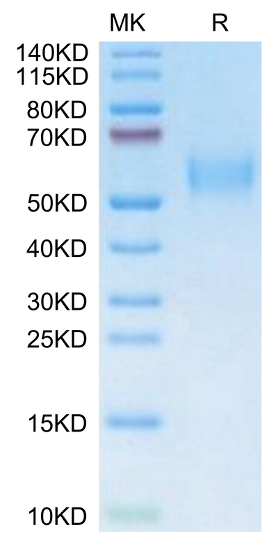 Mouse uPAR isoform 1 on Tris-Bis PAGE under reduced condition. The purity is greater than 95%.Recombinant Mouse uPAR/PLAUR isoform 1 Protein, Active