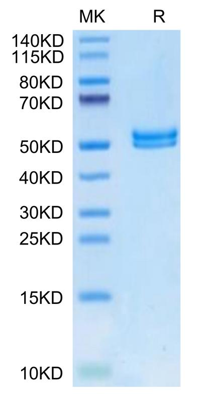 Mouse IL-11R alpha on Tris-Bis PAGE under reduced condition. The purity is greater than 95%.Recombinant Mouse IL-11R alpha Protein
