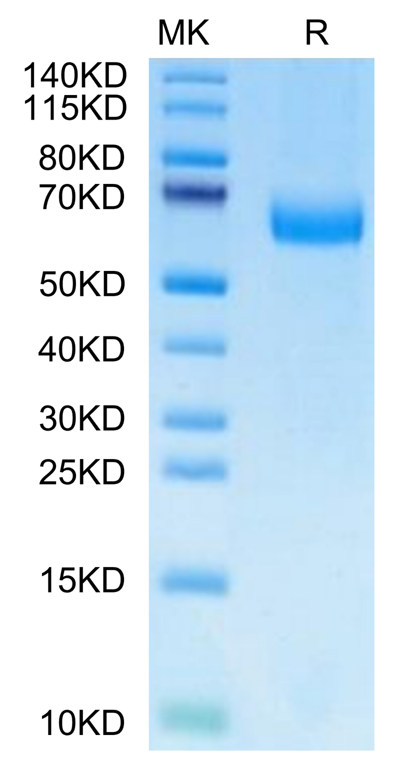 Mouse Alkaline phosphatase (Intestinal type) on Tris-Bis PAGE under reduced condition. The purity is greater than 95%.Recombinant Mouse Alkaline phosphatase (Intestinal type) /ALPI Protein
