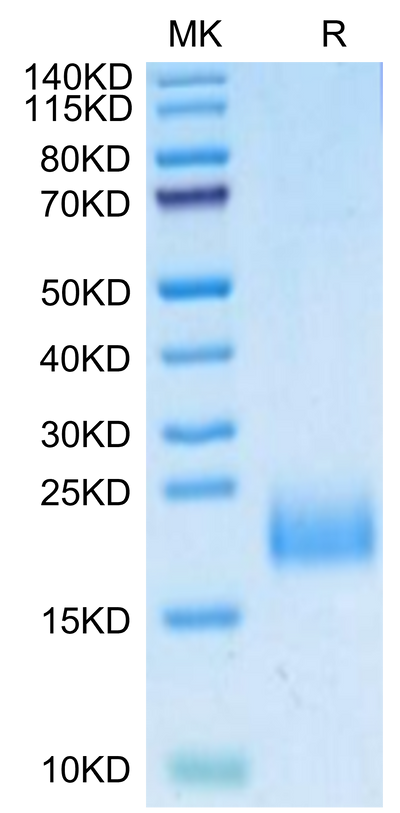 Human uPAR Domain 1 on Tris-Bis PAGE under reduced condition. The purity is greater than 95%.Recombinant Human uPAR/PLAUR Domain 1 Protein