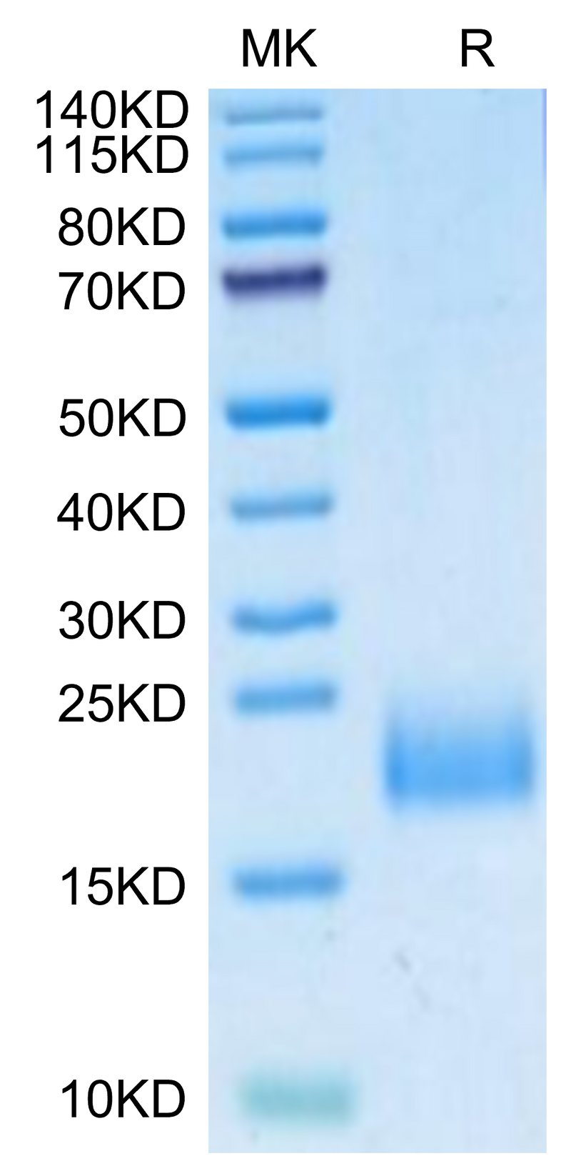 Human uPAR Domain 1 on Tris-Bis PAGE under reduced condition. The purity is greater than 95%.Recombinant Human uPAR/PLAUR Domain 1 Protein
