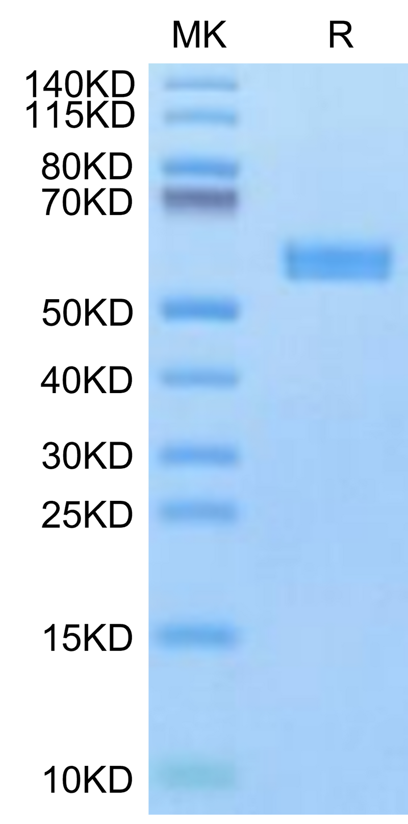 Biotinylated Human HLA-A*24:02&B2M&Survivin 2B (AYACNTSTL) Monomer on Tris-Bis PAGE under reduced condition. The purity is greater than 95%.Biotinylated Human HLA-A*24:02&B2M&Survivin 2B (AYACNTSTL) Monomer Protein