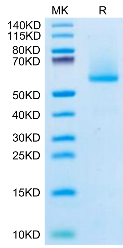 Biotinylated Human FGF21 on Tris-Bis PAGE under reduced condition. The purity is greater than 95%.Biotinylated Human FGF21 Protein, Active