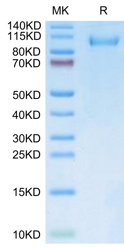 FITC-Labeled Human CDH17 on Tris-Bis PAGE under reduced condition. The purity is greater than 95%.Recombinant FITC-Labeled Human CDH17/Cadherin 17 Protein
