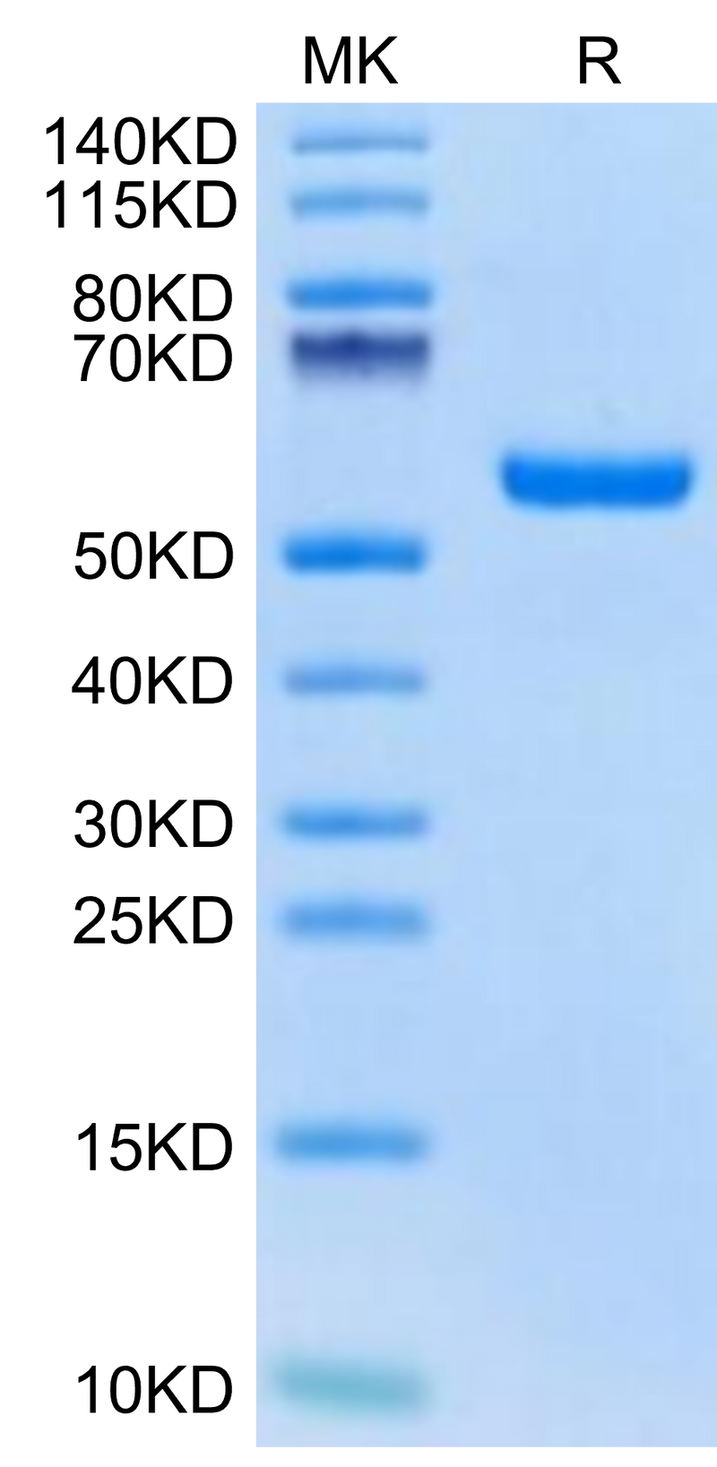 Biotinylated Human HLA-A*02:01&B2M&Survivin (LMLGEFLKL) Monomer on Tris-Bis PAGE under reduced condition. The purity is greater than 95%.Biotinylated Human HLA-A*02:01&B2M&Survivin (LMLGEFLKL) Monomer Protein