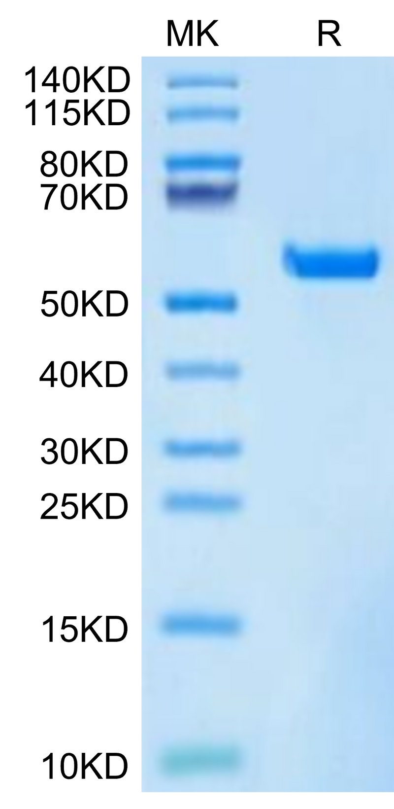 Biotinylated Human HLA-A*11:01&B2M&KRAS WT (VVVGAGGVGK) Monomer on Tris-Bis PAGE under reduced condition. The purity is greater than 95%.Biotinylated Human HLA-A*11:01&B2M&KRAS WT (VVVGAGGVGK) Monomer Protein