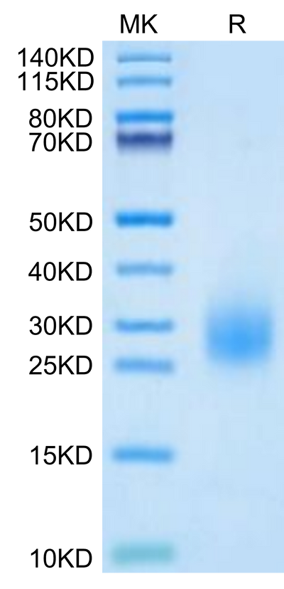 Human uPAR Domain 3 on Tris-Bis PAGE under reduced condition. The purity is greater than 95%.Recombinant Human uPAR/PLAUR Domain 3 Potein