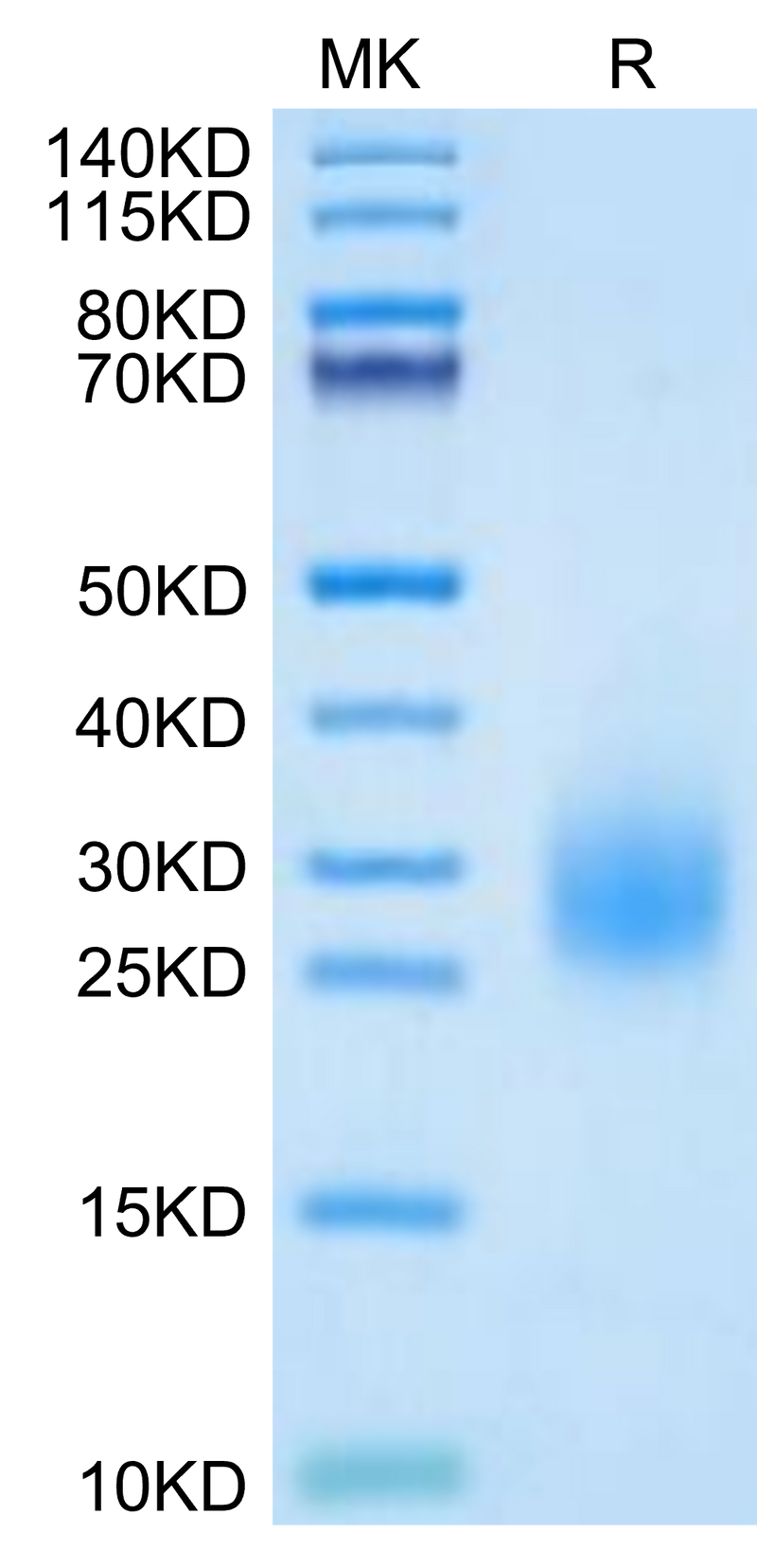 Human uPAR Domain 3 on Tris-Bis PAGE under reduced condition. The purity is greater than 95%.Recombinant Human uPAR/PLAUR Domain 3 Potein