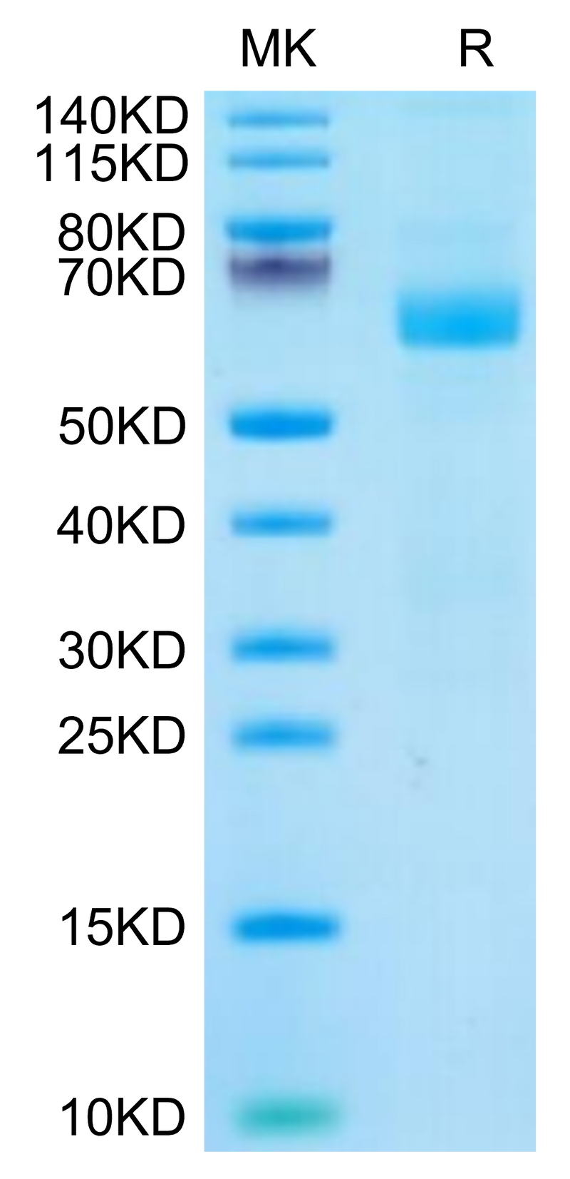 Cynomolgus LILRA4 on Tris-Bis PAGE under reduced condition. The purity is greater than 95%.Recombinant Cynomolgus LILRA4/CD85g Protein