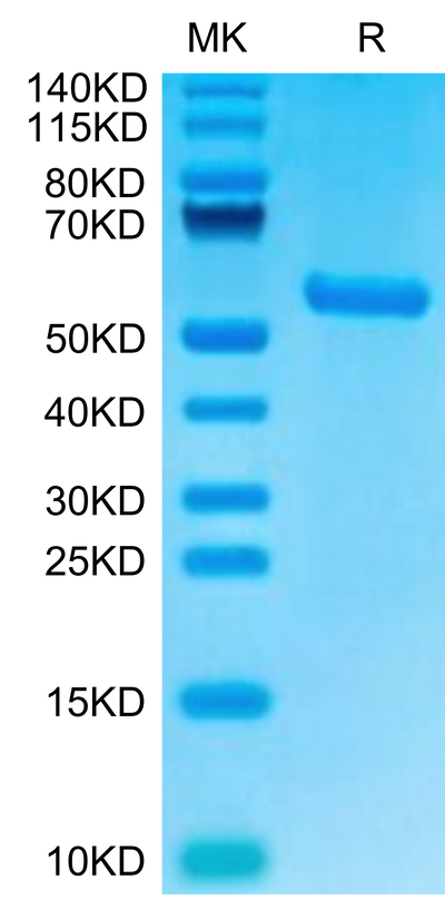 Biotinylated Human HLA-A*02:01&B2M&AFP (PLFQVPEPV) Monomer on Tris-Bis PAGE under reduced condition. The purity is greater than 95%.Biotinylated Human HLA-A*02:01&B2M&AFP (PLFQVPEPV) Monomer Protein