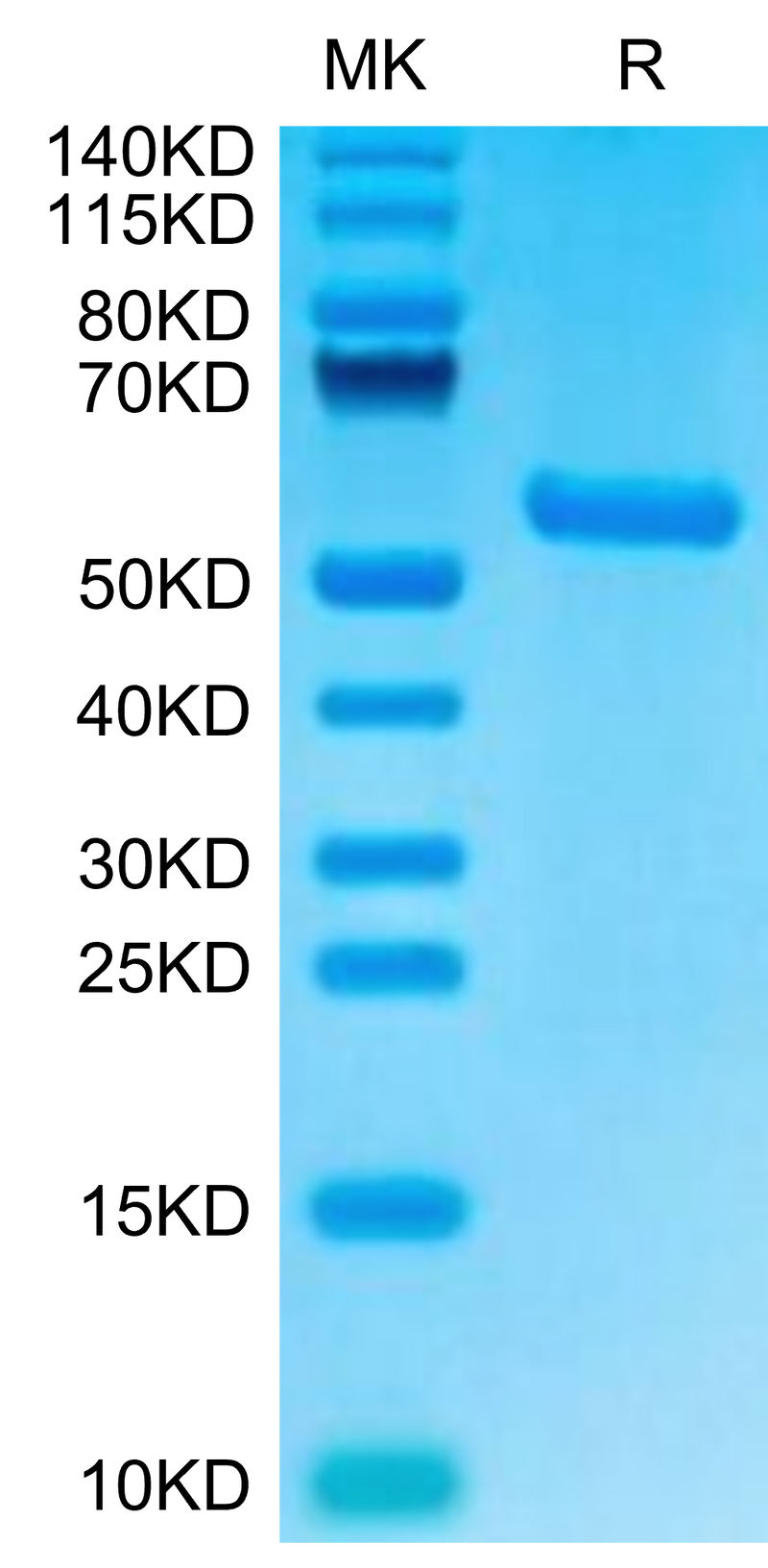 Biotinylated Human HLA-A*02:01&B2M&AFP (PLFQVPEPV) Monomer on Tris-Bis PAGE under reduced condition. The purity is greater than 95%.Biotinylated Human HLA-A*02:01&B2M&AFP (PLFQVPEPV) Monomer Protein