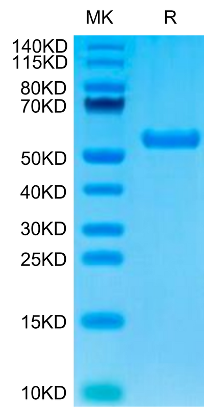 Biotinylated Human HLA-A*02:01&B2M&AFP (FMNKFIYEI) Monomer on Tris-Bis PAGE under reduced condition. The purity is greater than 95%.Biotinylated Human HLA-A*02:01&B2M&AFP (FMNKFIYEI) Monomer Protein, Active