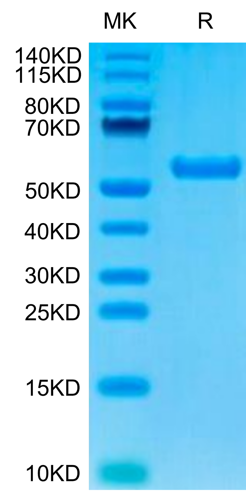 Biotinylated Human HLA-A*02:01&B2M&AFP (FMNKFIYEI) Monomer on Tris-Bis PAGE under reduced condition. The purity is greater than 95%.Biotinylated Human HLA-A*02:01&B2M&AFP (FMNKFIYEI) Monomer Protein, Active