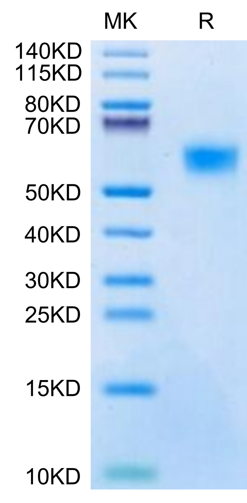 Biotinylated Mouse uPAR on Tris-Bis PAGE under reduced condition. The purity is greater than 95%.Biotinylated Mouse uPAR/PLAUR Protein, Active