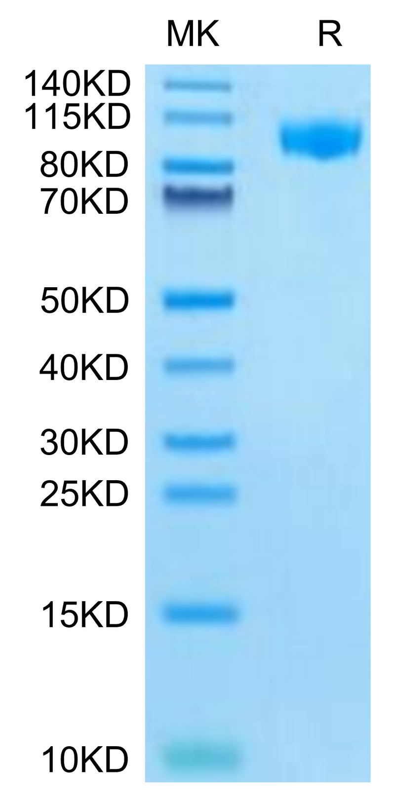 Mouse G-CSF R on Tris-Bis PAGE under reduced condition. The purity is greater than 95%.Recombinant Mouse G-CSF R/CD114-Protein, Active