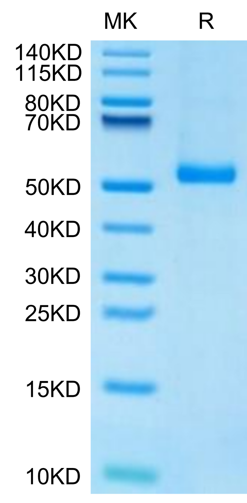 Mouse Notch 4 on Tris-Bis PAGE under reduced condition. The purity is greater than 95%.Recombinant Mouse Notch 4 Protein