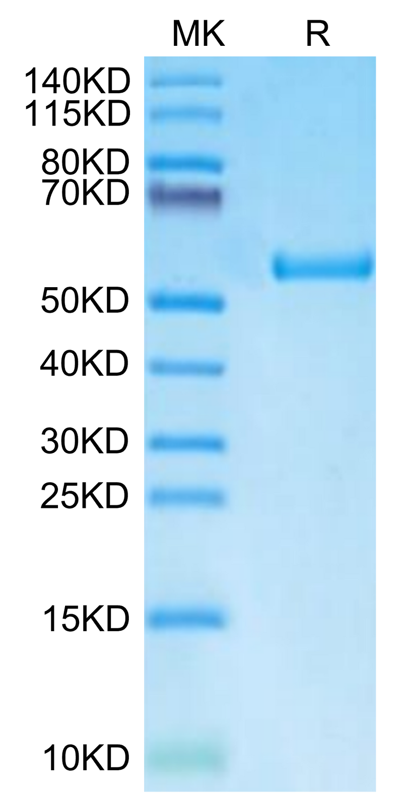 Biotinylated Human HLA-A*11:01&B2M&LMP2 (SSCSSCPLTK) Monomer on Tris-Bis PAGE under reduced condition. The purity is greater than 95%.Biotinylated Human HLA-A*11:01&B2M&LMP2 (SSCSSCPLTK) Monomer Protein