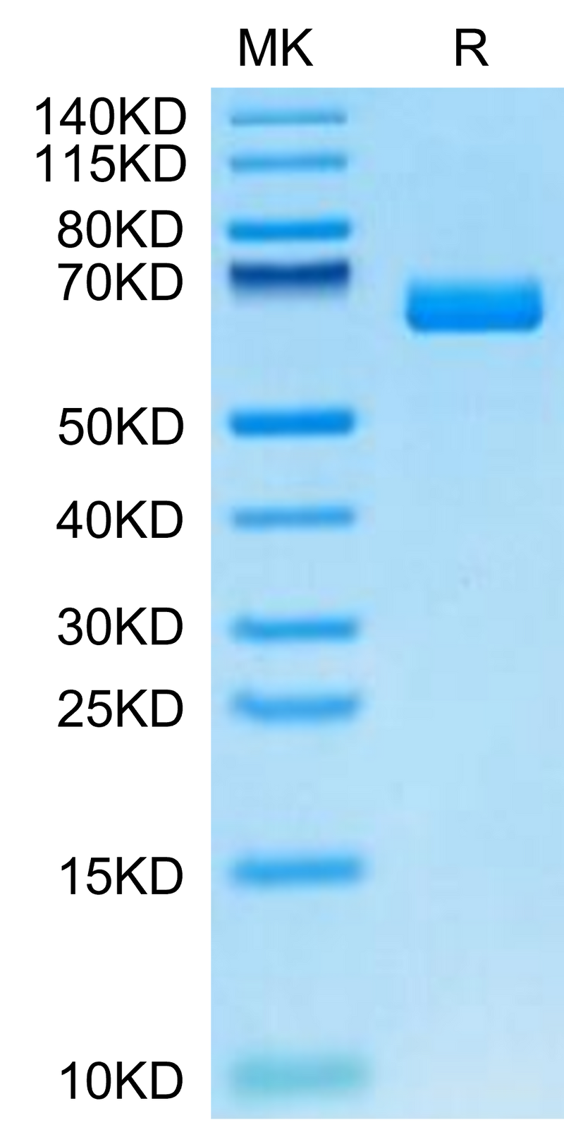 Cynomolgus EPHA2 on Tris-Bis PAGE under reduced condition. The purity is greater than 95%.Recombinant Cynomolgus EPHA2 Protein