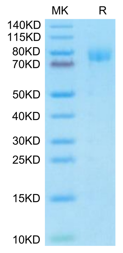Mouse MUC18 on Tris-Bis PAGE under reduced condition. The purity is greater than 95%.Recombinant Mouse MUC18/CD146 Protein