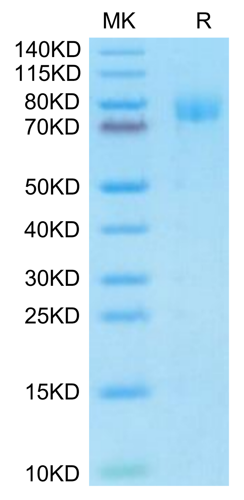 Mouse MUC18 on Tris-Bis PAGE under reduced condition. The purity is greater than 95%.Recombinant Mouse MUC18/CD146 Protein