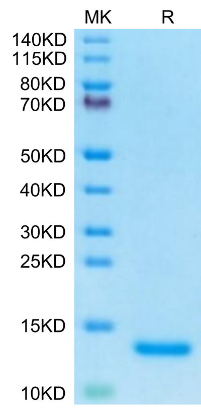 Human C5a on Tris-Bis PAGE under reduced condition. The purity is greater than 95%.Recombinant Human Complement C5a Protein