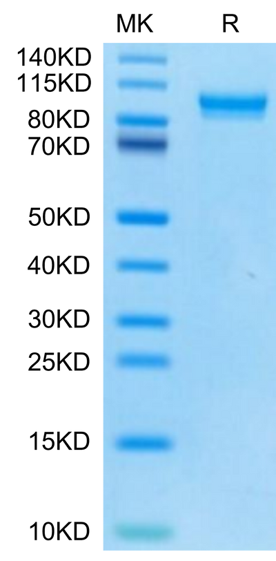 Mouse MMP-9 on Tris-Bis PAGE under reduced condition. The purity is greater than 95%.Recombinant Mouse MMP-9 Protein