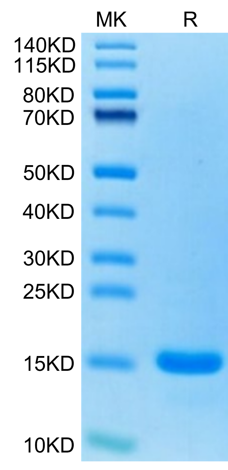 Human CCL7 on Tris-Bis PAGE under reduced condition. The purity is greater than 95%.Recombinant Human CCL7/MCP3 Protein