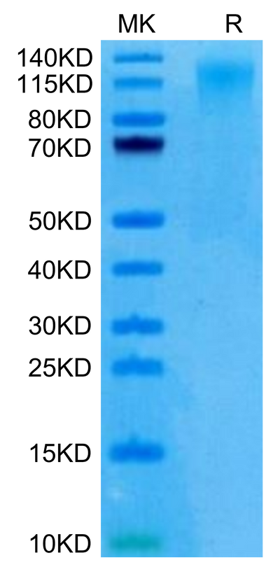 Human CD96 (C110S) on Tris-Bis PAGE under reduced condition. The purity is greater than 95%.Recombinant Human CD96/TACTILE (C110S) Protein, Active