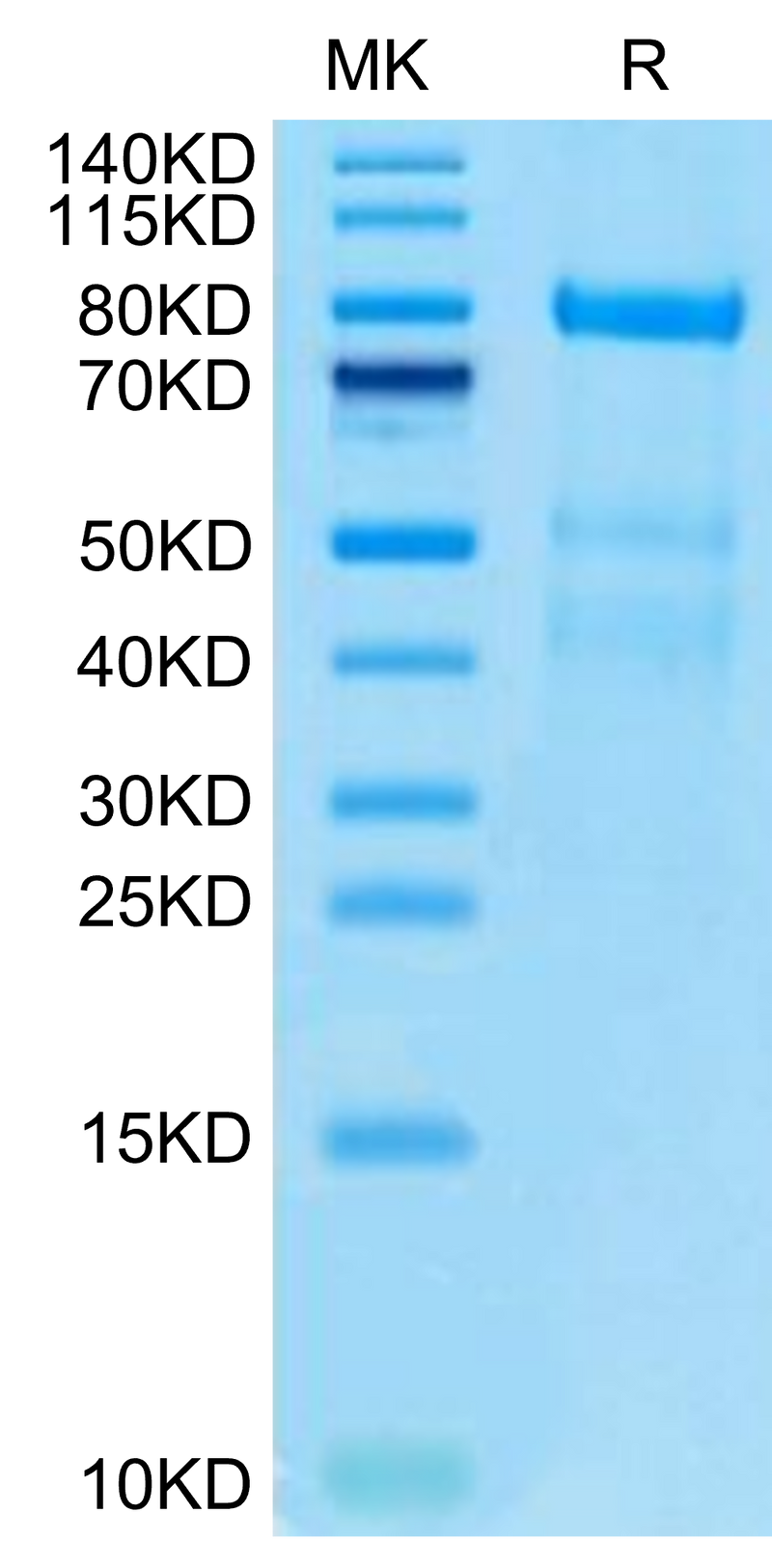 Human Complement factor I on Tris-Bis PAGE under reduced condition. The purity is greater than 95%.Recombinant Human Complement factor I Protein