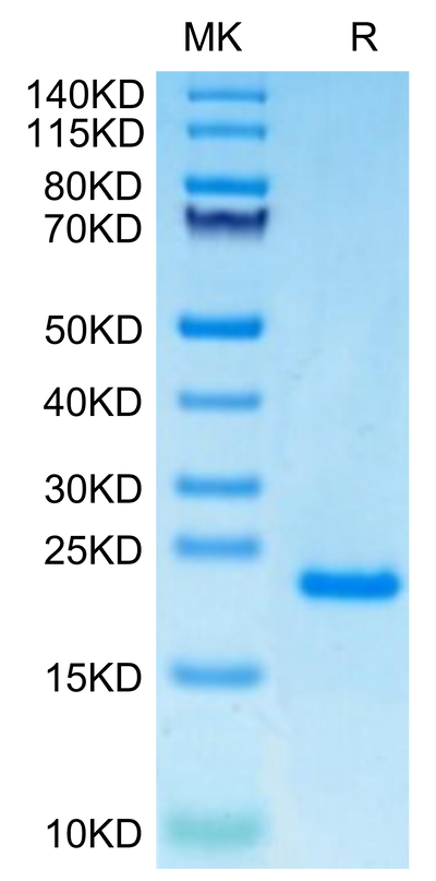 Human PRL-1 on Tris-Bis PAGE under reduced condition. The purity is greater than 95%.Recombinant Human PRL-1/PTP4A1 Protein