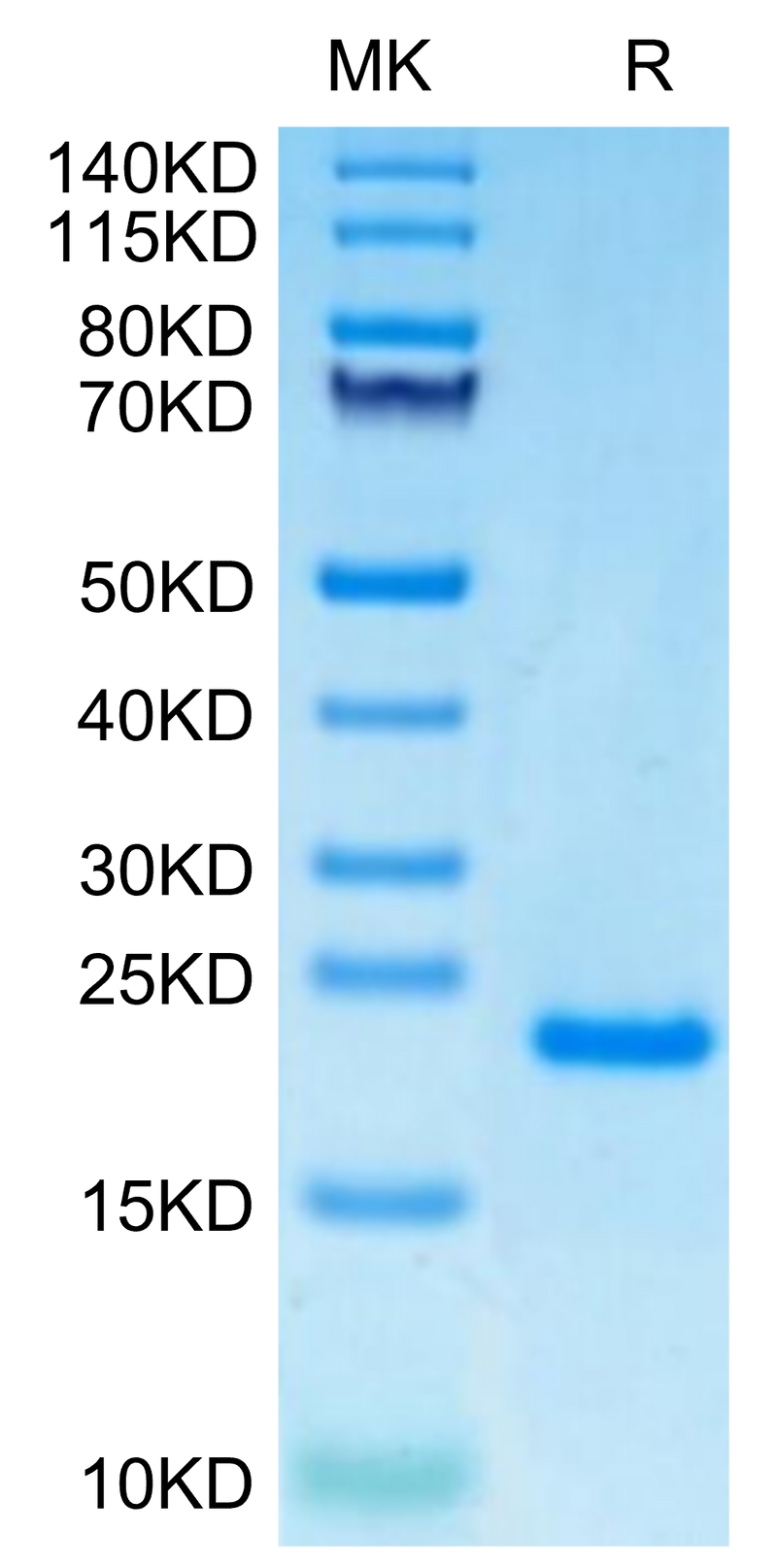 Human PRL-1 on Tris-Bis PAGE under reduced condition. The purity is greater than 95%.Recombinant Human PRL-1/PTP4A1 Protein