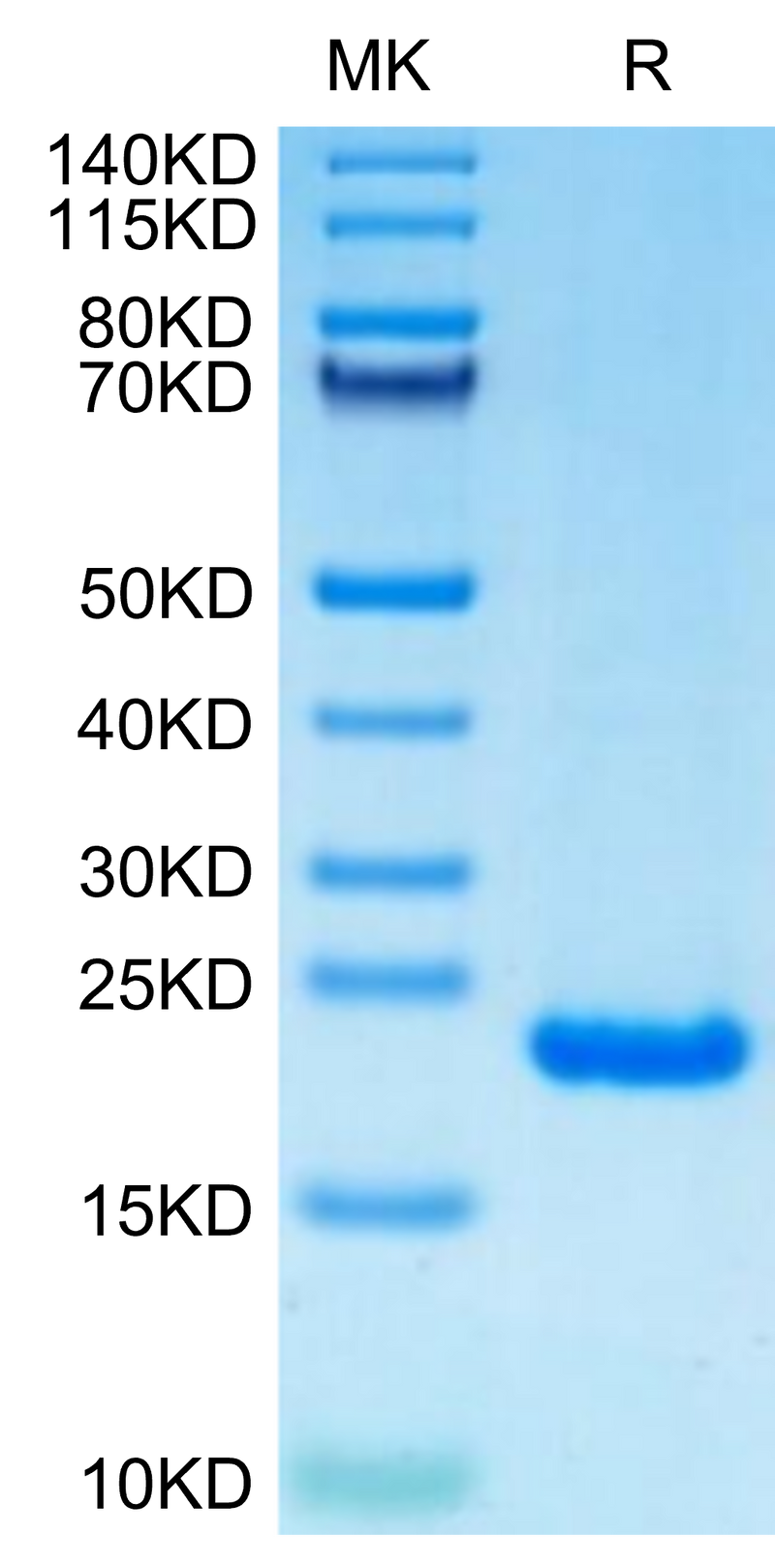 Human PRL-2 on Tris-Bis PAGE under reduced condition. The purity is greater than 95%.Recombinant Human PRL-2/PTP4A2 Protein