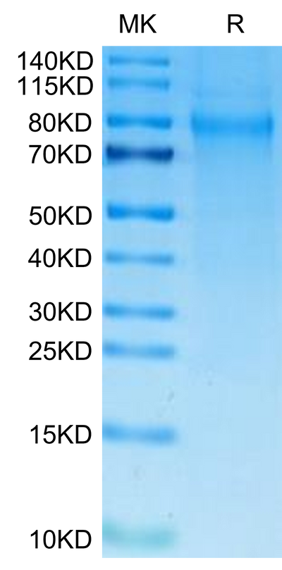 Human TIM-4 on Tris-Bis PAGE under reduced condition. The purity is greater than 95%.Recombinant Human TIM-4 Protein