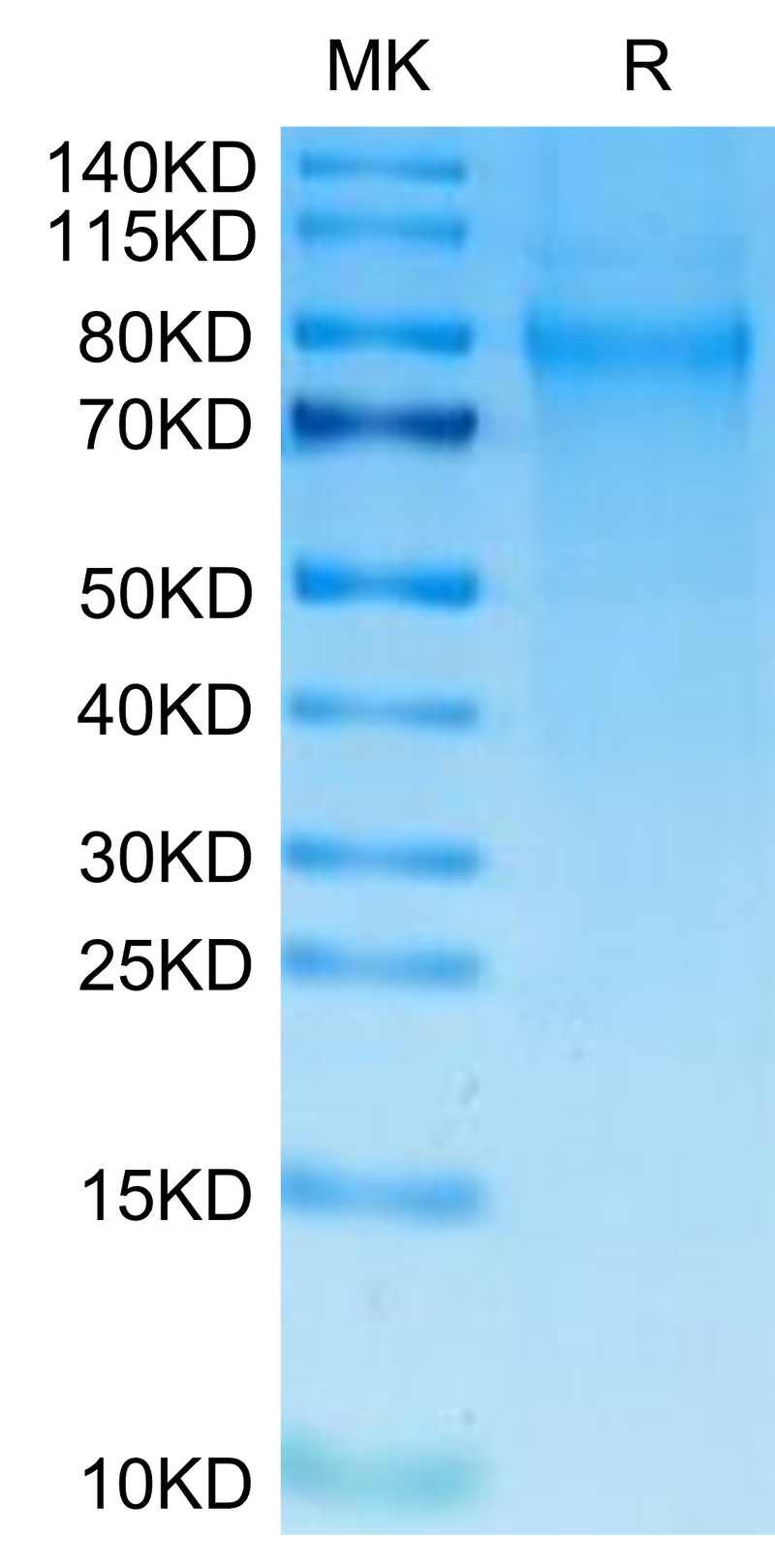 Human TIM-4 on Tris-Bis PAGE under reduced condition. The purity is greater than 95%.Recombinant Human TIM-4 Protein