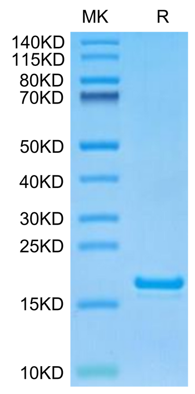 Monkeypox virus L1R on Tris-Bis PAGE under reduced condition. The purity is greater than 95%.Recombinant Monkeypox virus L1R Protein