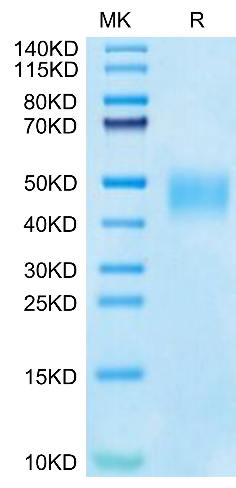 Cynomolgus SLAMF7 on Tris-Bis PAGE under reduced condition. The purity is greater than 95%.Recombinant Cynomolgus SLAMF7/CRACC/CD319 Protein