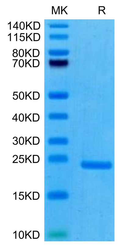 Human PRL-3 on Tris-Bis PAGE under reduced condition. The purity is greater than 95%.Recombinant Human PRL-3/PTP4A3 Protein