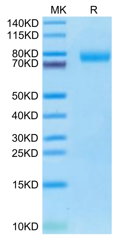 Cynomolgus BCAM on Tris-Bis PAGE under reduced condition. The purity is greater than 95%.Recombinant Cynomolgus BCAM Protein